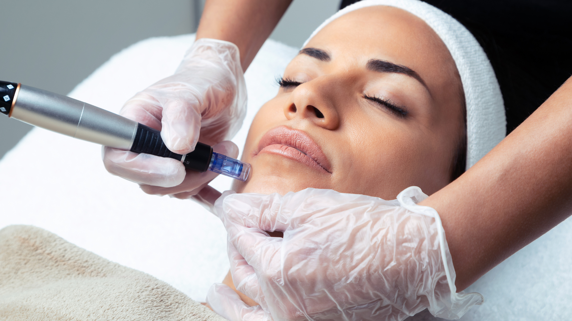 Microneedling met RF