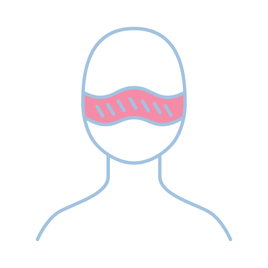 Rosacea